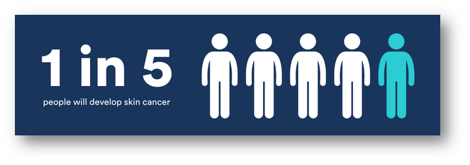 Blue Skin Cancer Statistic - 1 in 5 people will develop skin cancer
